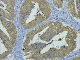 CK-8 Monoclonal Antibody