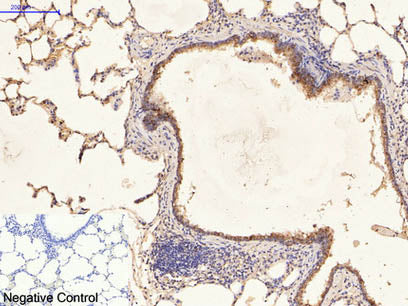 CK-16 Monoclonal Antibody
