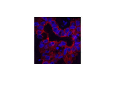 CK-16 Monoclonal Antibody
