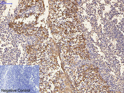 CK-16 Monoclonal Antibody