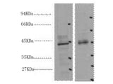 CDX2 Monoclonal Antibody