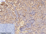 GFAP Monoclonal Antibody