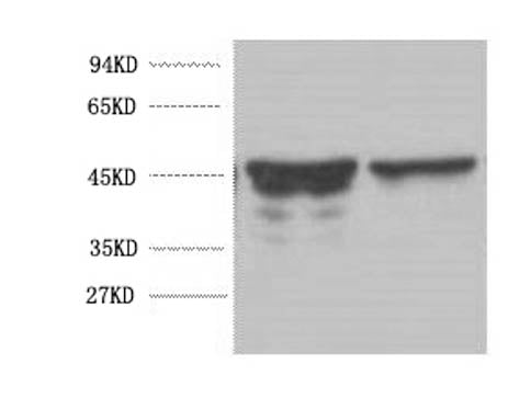 GFAP Monoclonal Antibody