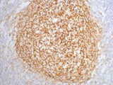 CD21 Monoclonal Antibody