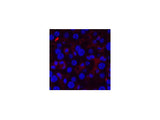 CD21 Monoclonal Antibody
