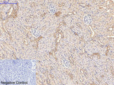 CD21 Monoclonal Antibody