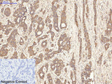 AQP4 Monoclonal Antibody
