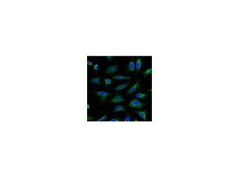 AQP4 Monoclonal Antibody