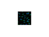 AQP4 Monoclonal Antibody