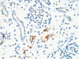 KIF7 Monoclonal Antibody