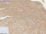 ENO2 Monoclonal Antibody