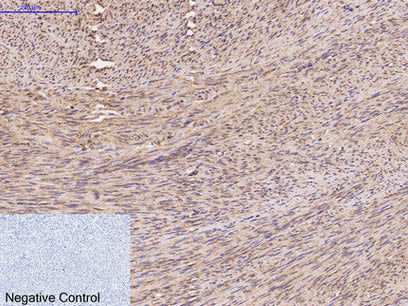 FH Monoclonal Antibody