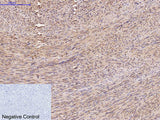 FH Monoclonal Antibody