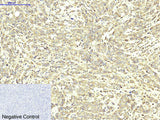 ABCB5 Monoclonal Antibody