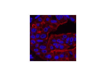 ABCB5 Monoclonal Antibody