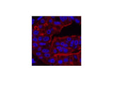 ABCB5 Monoclonal Antibody