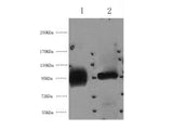 ABCB5 Monoclonal Antibody
