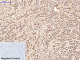 AFP Monoclonal Antibody
