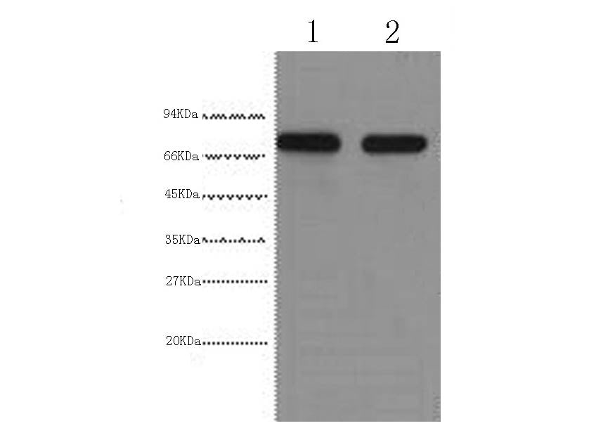 AFP Monoclonal Antibody