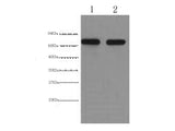 AFP Monoclonal Antibody