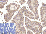 CA9 Monoclonal Antibody
