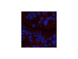 CA9 Monoclonal Antibody