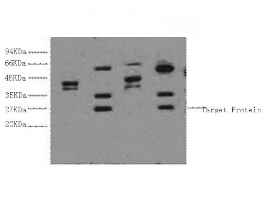 ERCC1 Monoclonal Antibody
