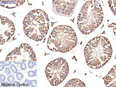 EFHD1 Monoclonal Antibody