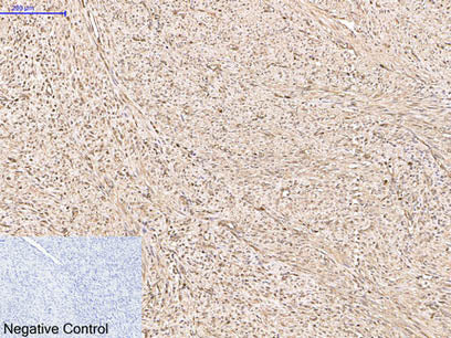 PRDX1 Monoclonal Antibody