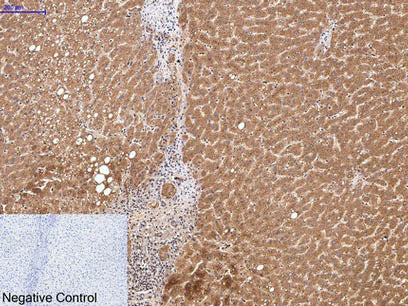 COL3A1 Monoclonal Antibody