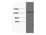 COL3A1 Monoclonal Antibody