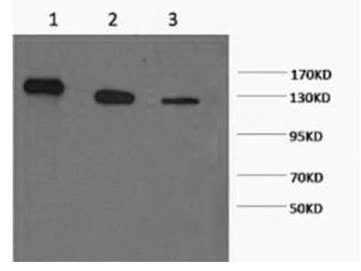 PARP1 Monoclonal Antibody