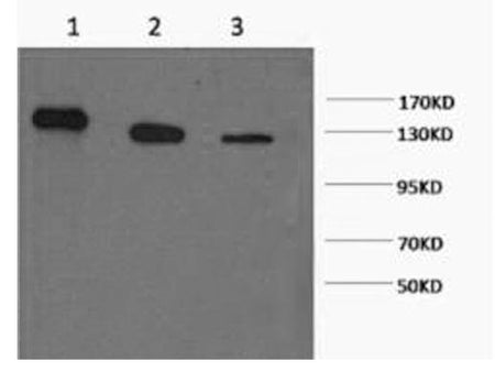 PARP1 Monoclonal Antibody