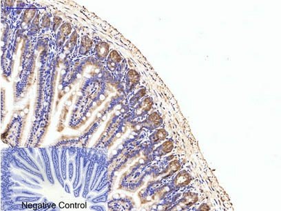 EIF4A1 Monoclonal Antibody
