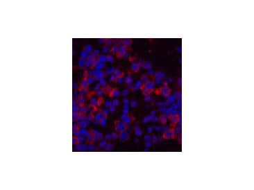 EIF4A1 Monoclonal Antibody