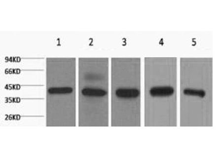 EIF4A1 Monoclonal Antibody