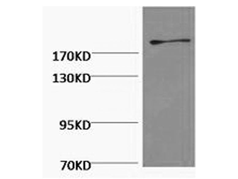 FN1 Monoclonal Antibody