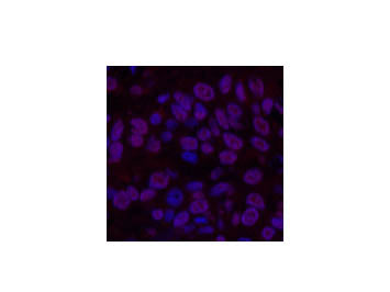 Transferrin Monoclonal Antibody Store at -20°C Isotype IgG