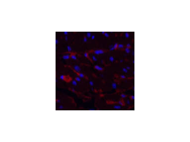 CD1A Monoclonal Antibody