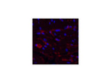 CD1A Monoclonal Antibody