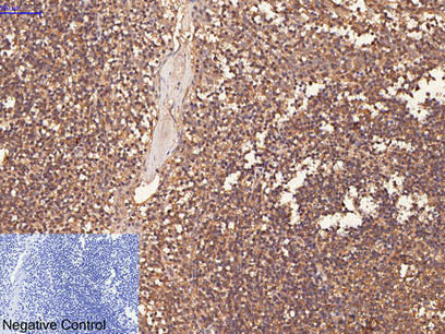 CD1A Monoclonal Antibody