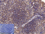 CD2 Monoclonal Antibody
