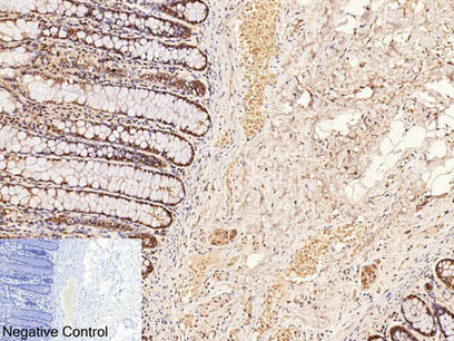 CD2 Monoclonal Antibody