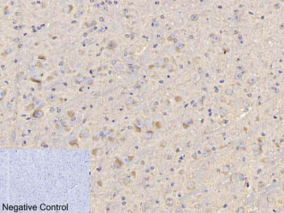 CD4 Monoclonal Antibody