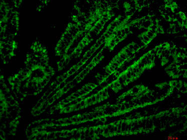 CD4 Monoclonal Antibody