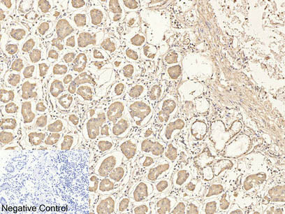 CD4 Monoclonal Antibody