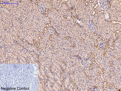 CD5 Monoclonal Antibody