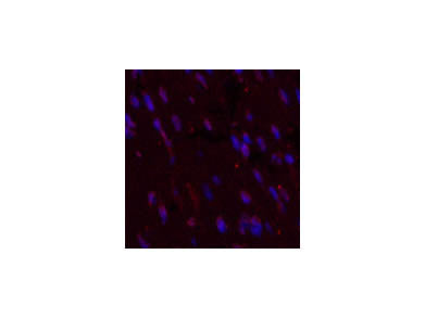 CD5 Monoclonal Antibody