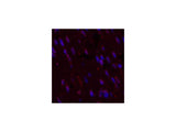 CD5 Monoclonal Antibody