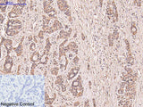 CD5 Monoclonal Antibody